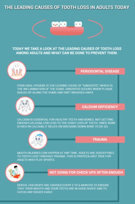 The leading causes of tooth loss in adults today