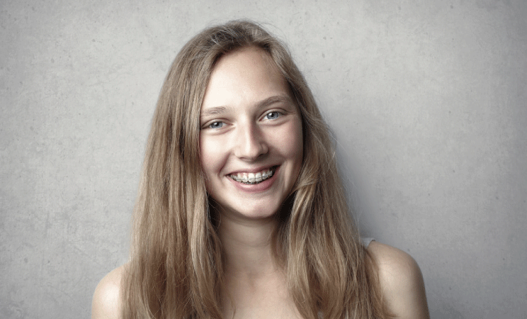 Benefits Of Invisible Braces