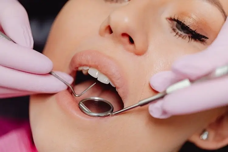 What are Fillings Made From, and When Are They Required?