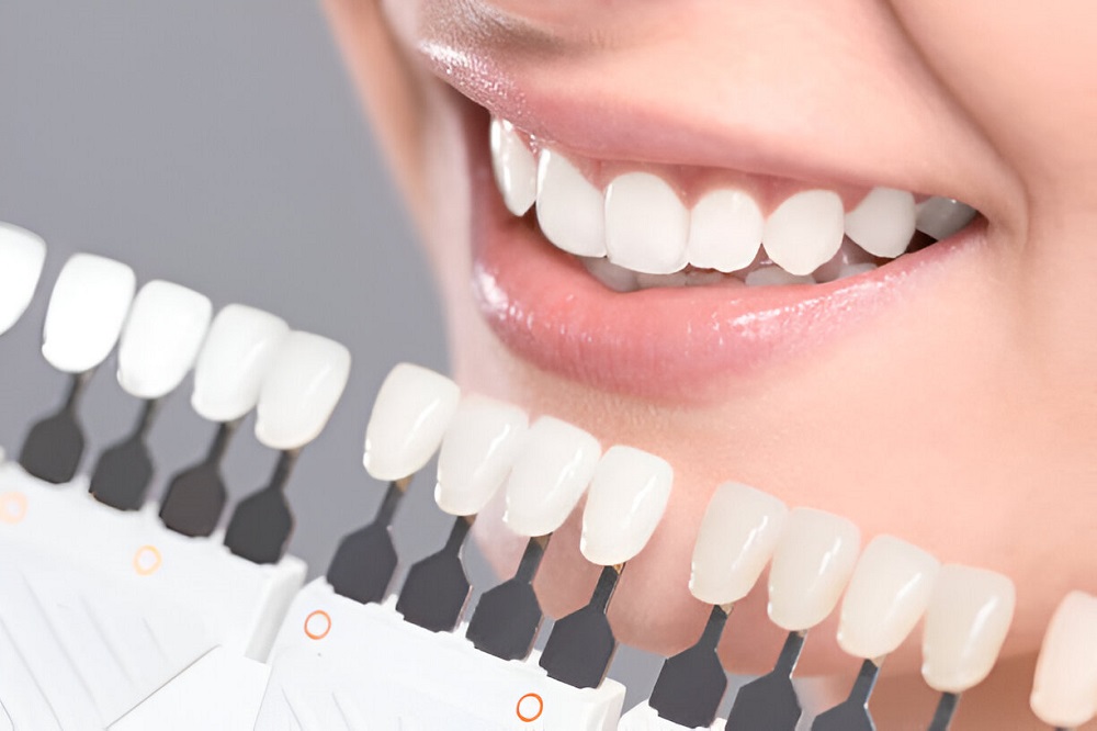 A Permanent Solution for Missing Teeth from Parramatta Dental Clinics